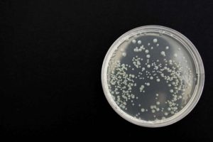 在培养皿中生长的细菌